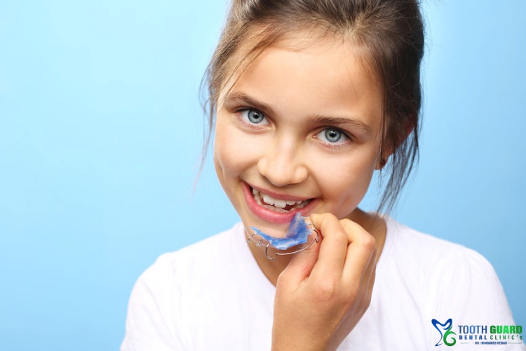 اسعار تقويم الاسنان للاطفال